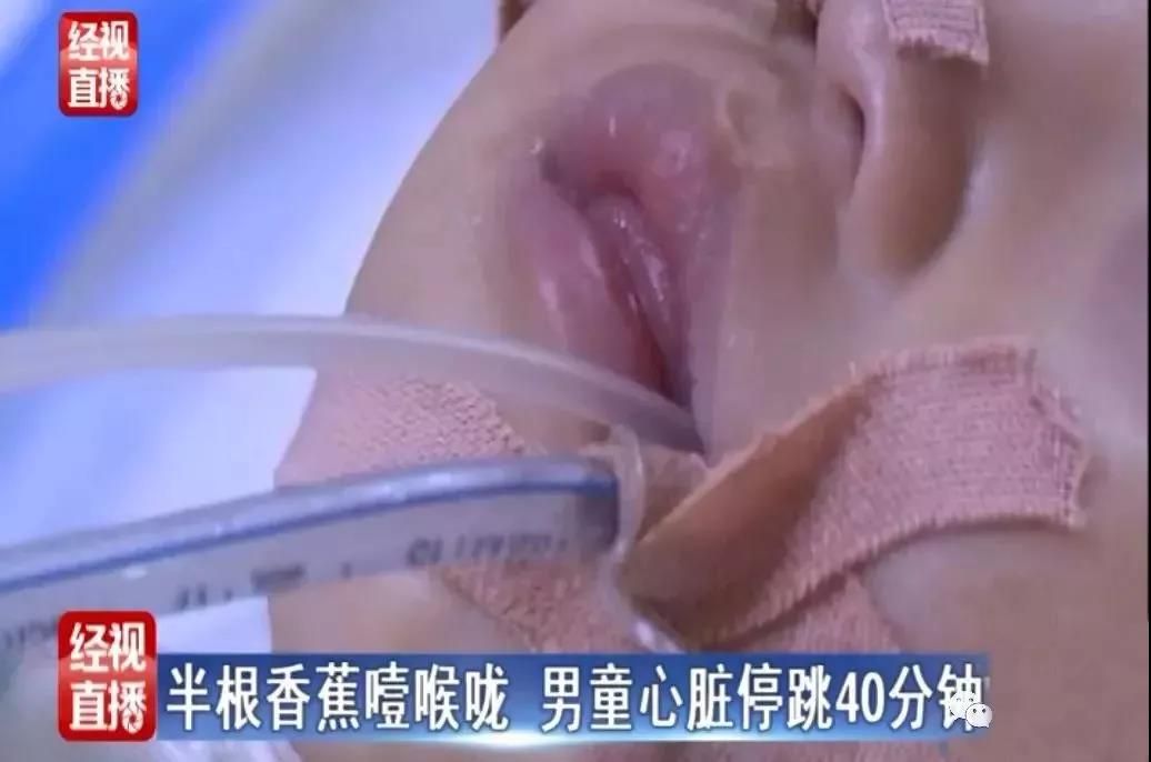 男童吃香蕉心脏停止半小时：别让你的无知，将孩子推向深渊！